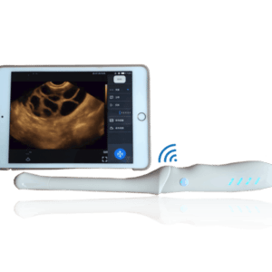 Sonde endocavitaire ( Ob/Gyn )